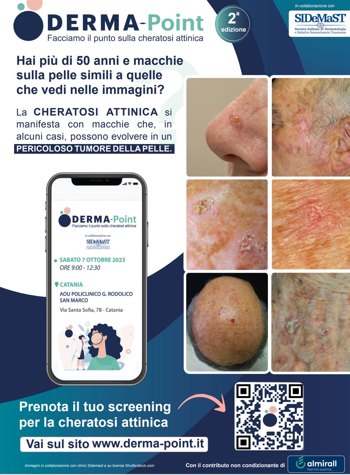 Al via la Campagna “Derma Point, facciamo il punto sulla Cheratosi attinica”. Screening dermatologici gratuiti in 12 strutture ospedaliere