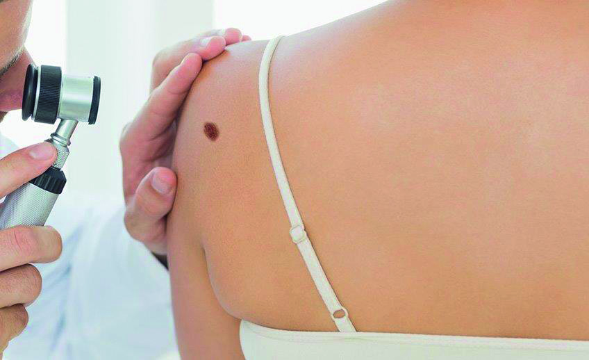 Skin Cancer: il melanoma fa meno paura. Confronto tra esperti internazionali, il 20 e il 21 ottobre, alla Camera di Commercio di Trapani